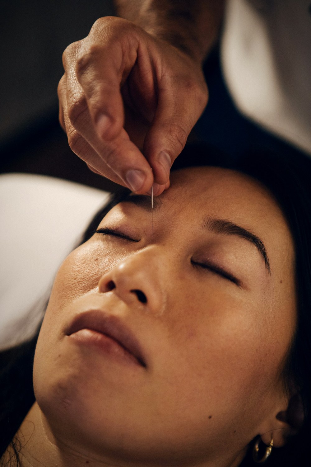Facial acupuncture during a classical session at Gateway